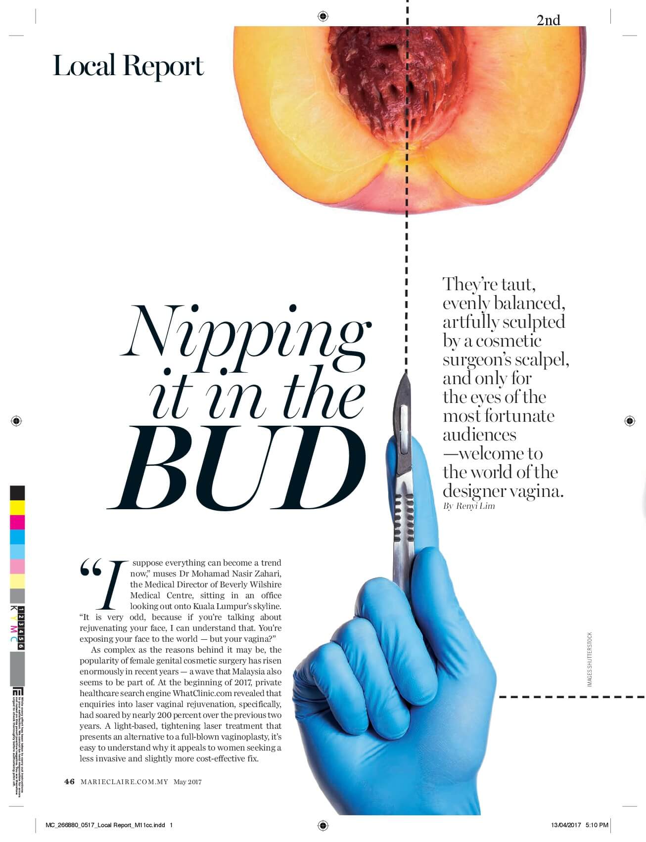 Nipping it in the BUD – By RenYi Lim