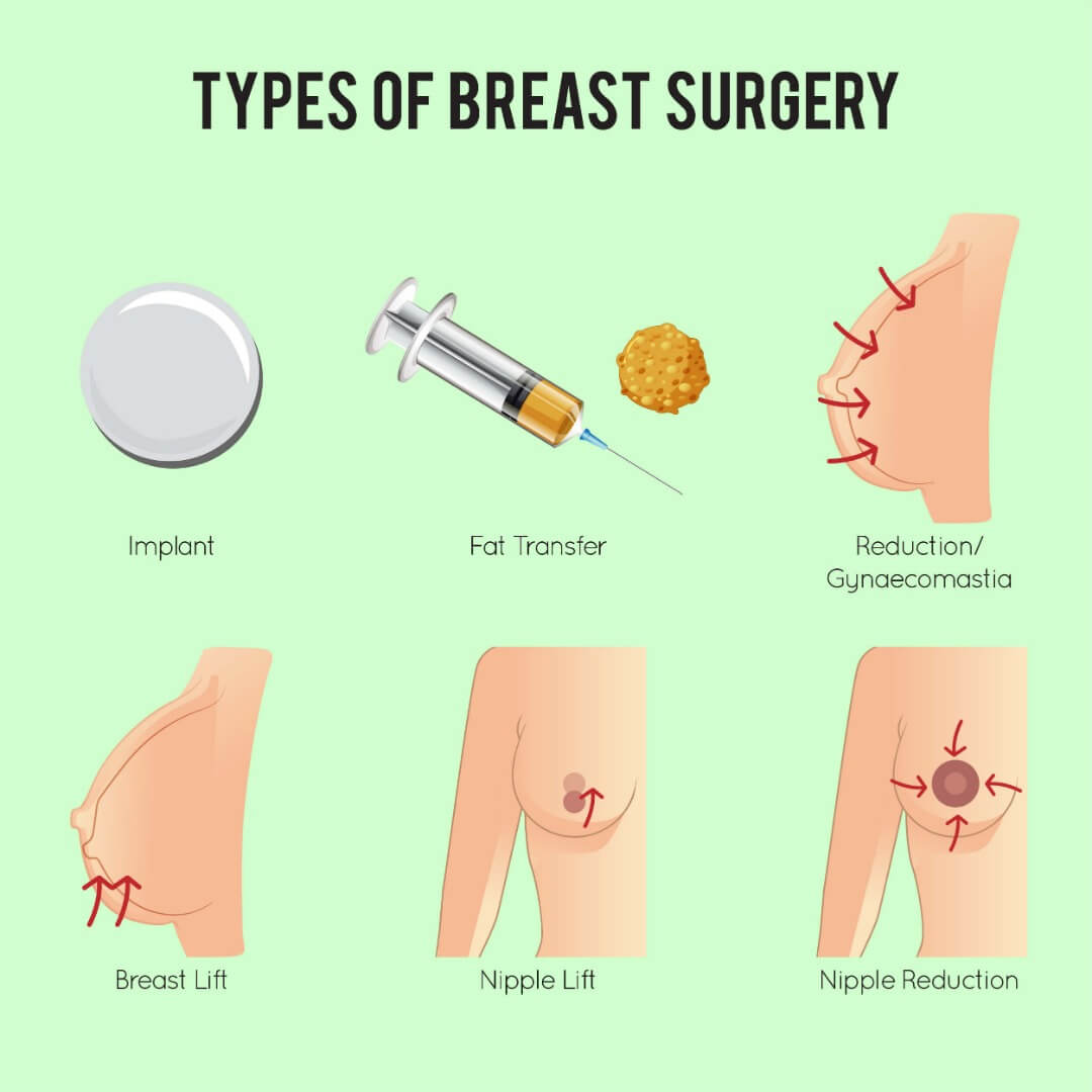 Types of Boob