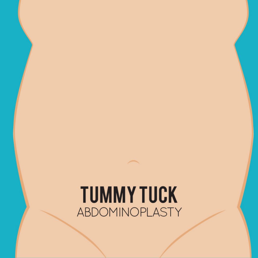 Tummy Tuck: Get Rid Of Spare Tire